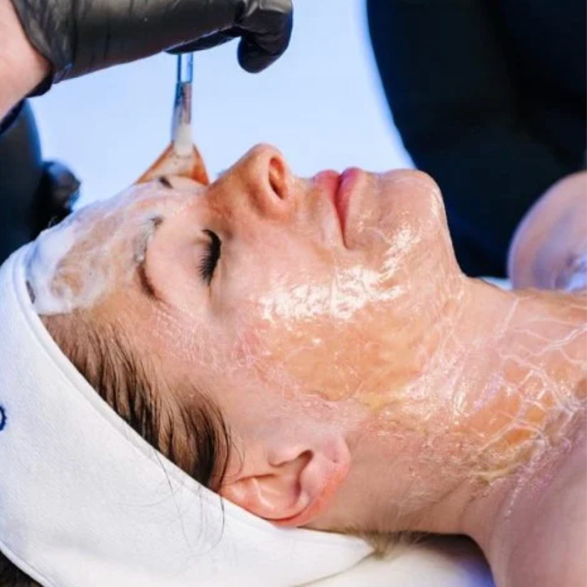 Firming Peptide Facial at Pure Platinum Esthetics in Dublin, OH
