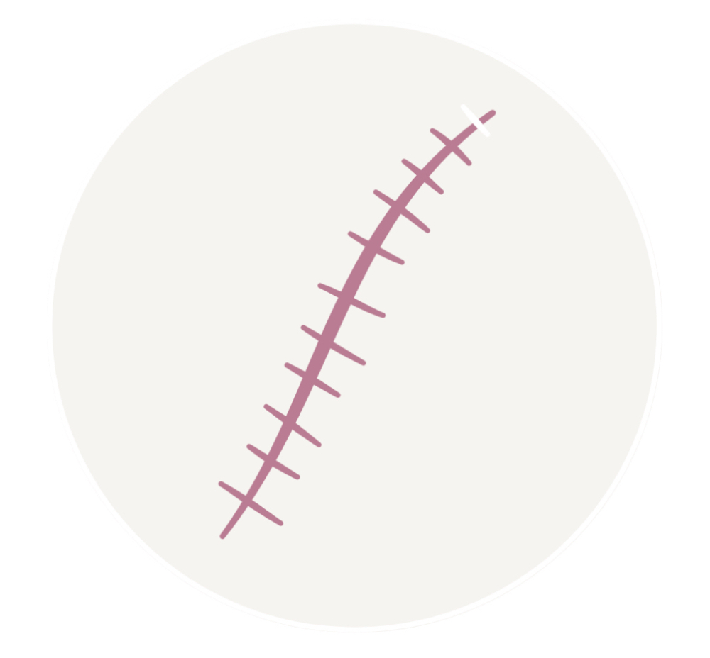 Scar Revision (Med-Large)