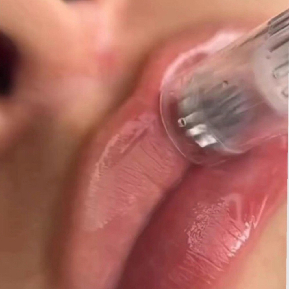 Nano Lip Plumping Hydration at Absolute Aesthetics in Gold Beach, OR