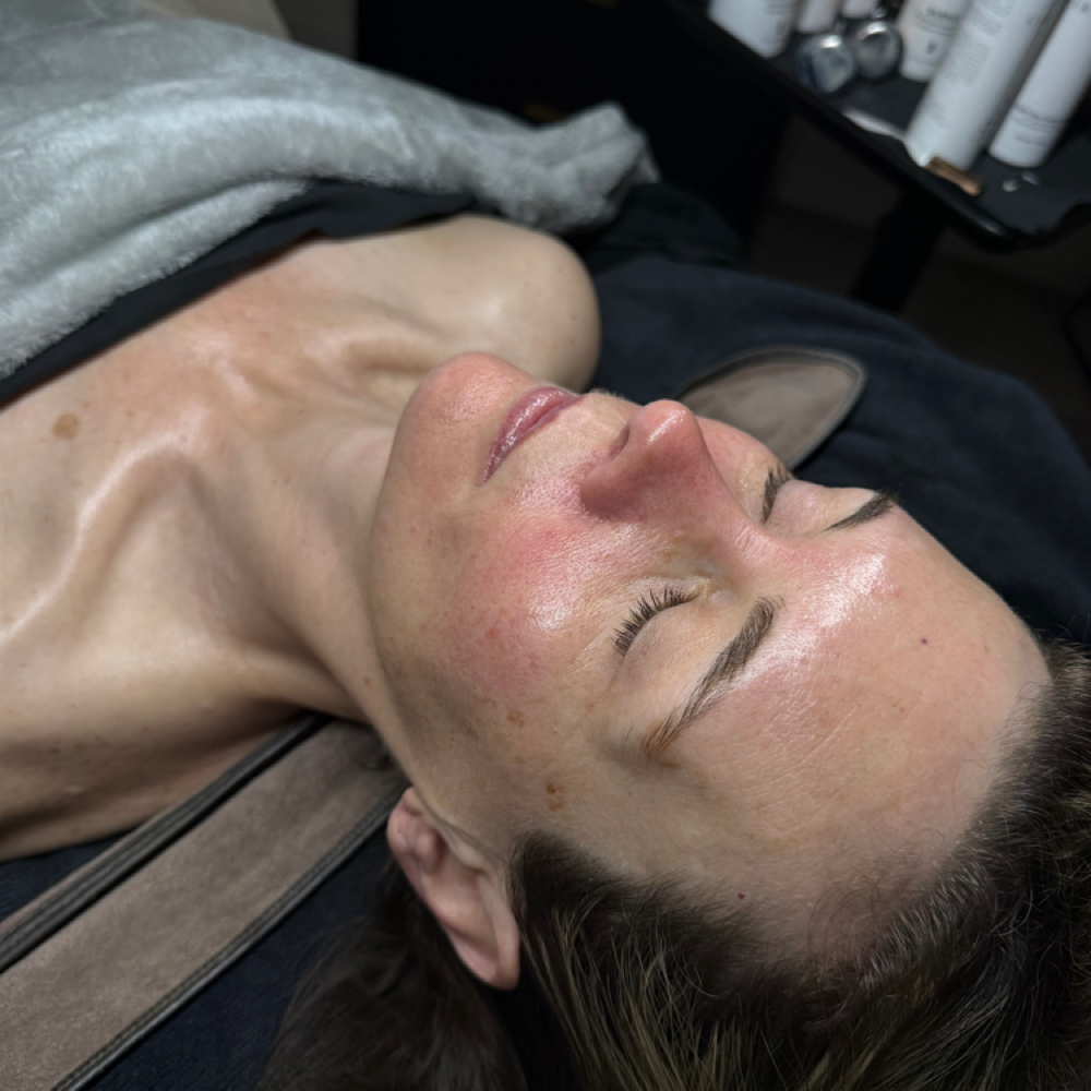 Osmosis Micro Channeling Facial at The Lash & Beauty Bar in Elk City, OK