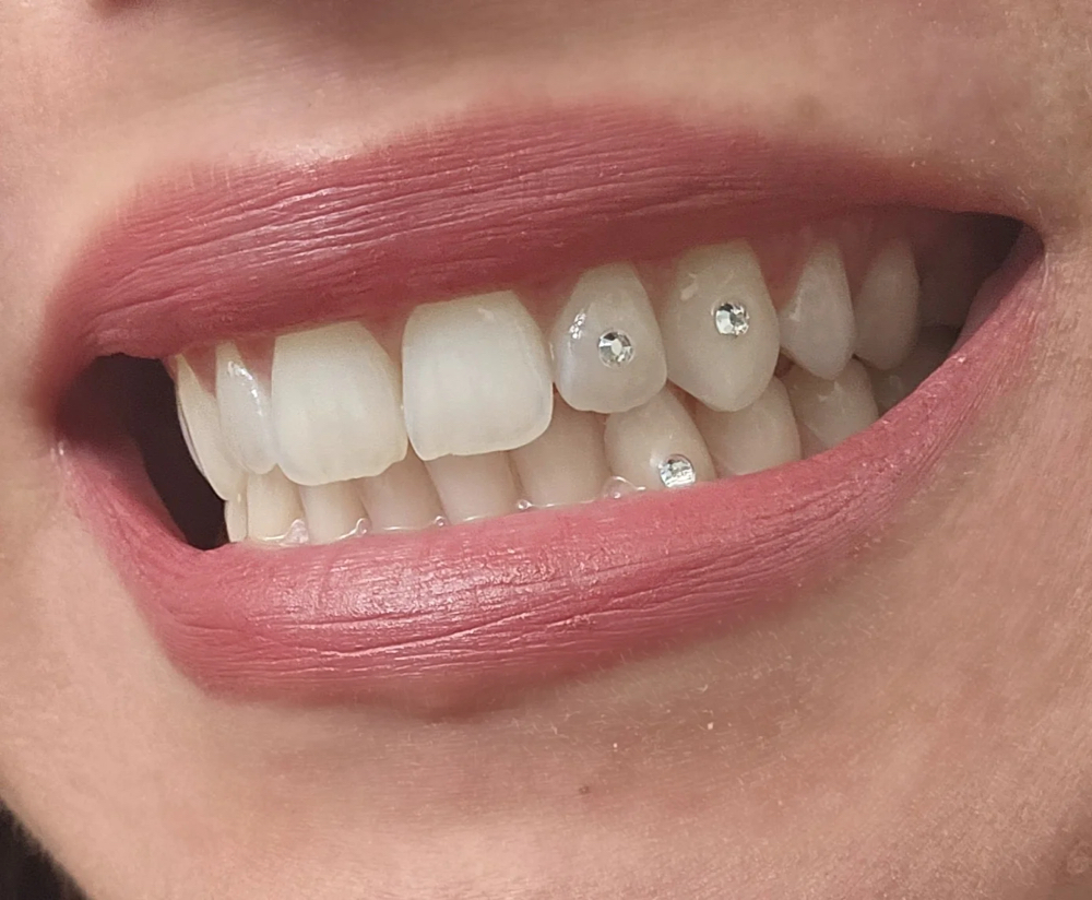 Tooth Gems
