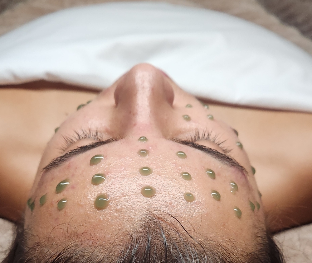 KrX INFLACURE SKIN THERAPY