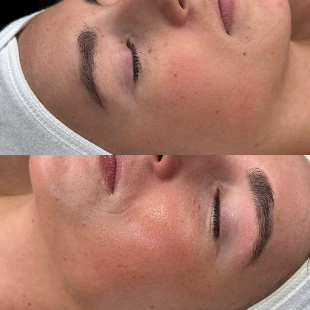 Signature Facial at Illuminate Lashes and Beauty in Trussville, AL