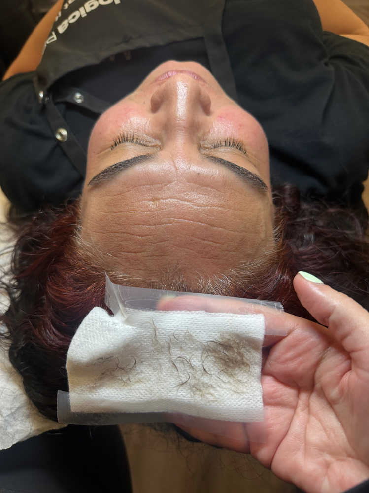 Dermaplaning Facial
