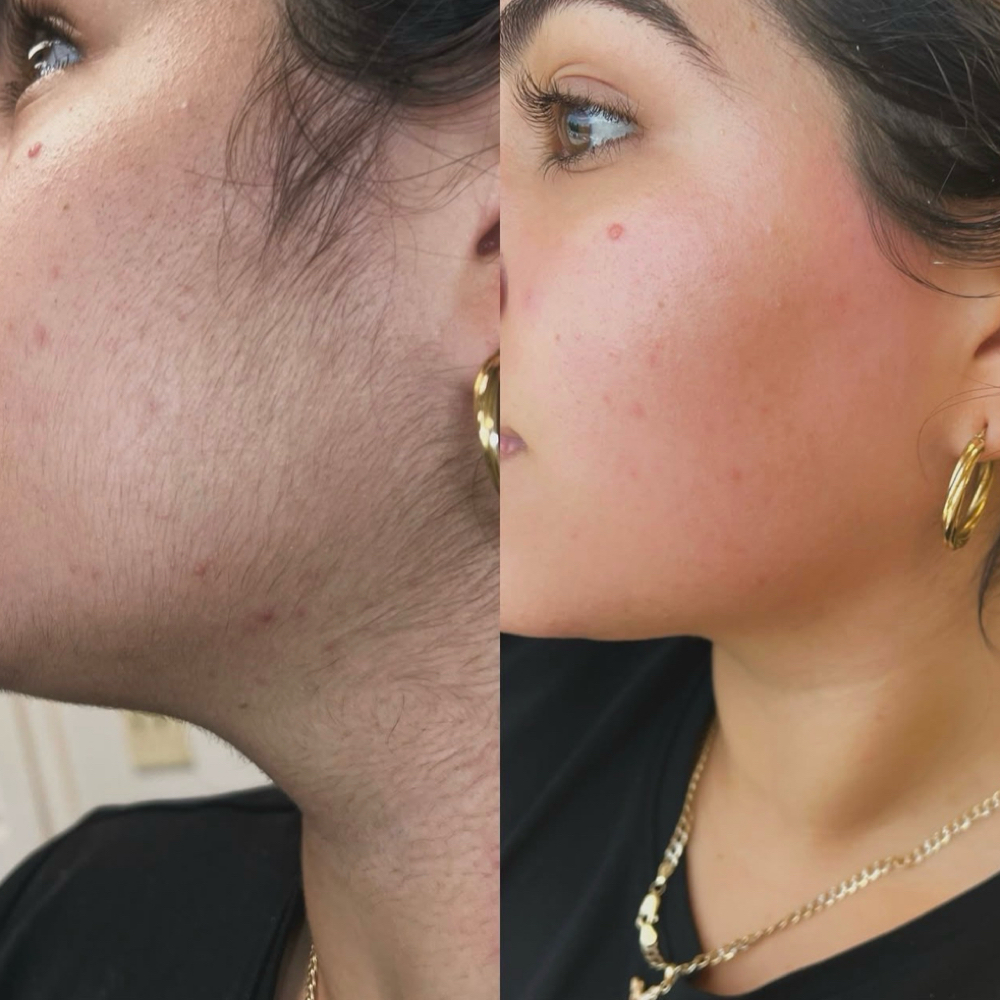 Full Face Wax at Blessed Beauty Aesthetics, LLC in Houston, TX