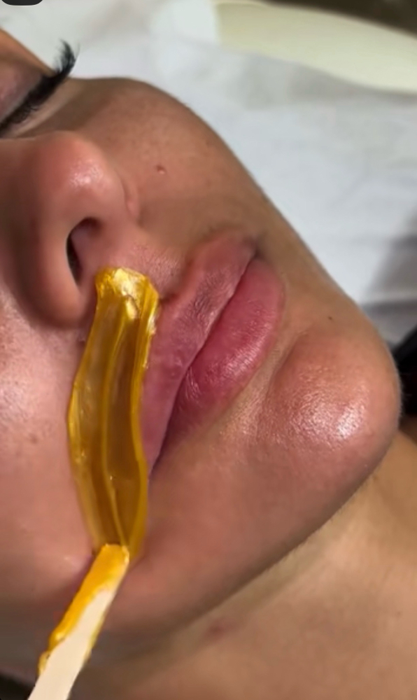 Upper Lip Wax at Celestial Aesthetics in College Station, TX