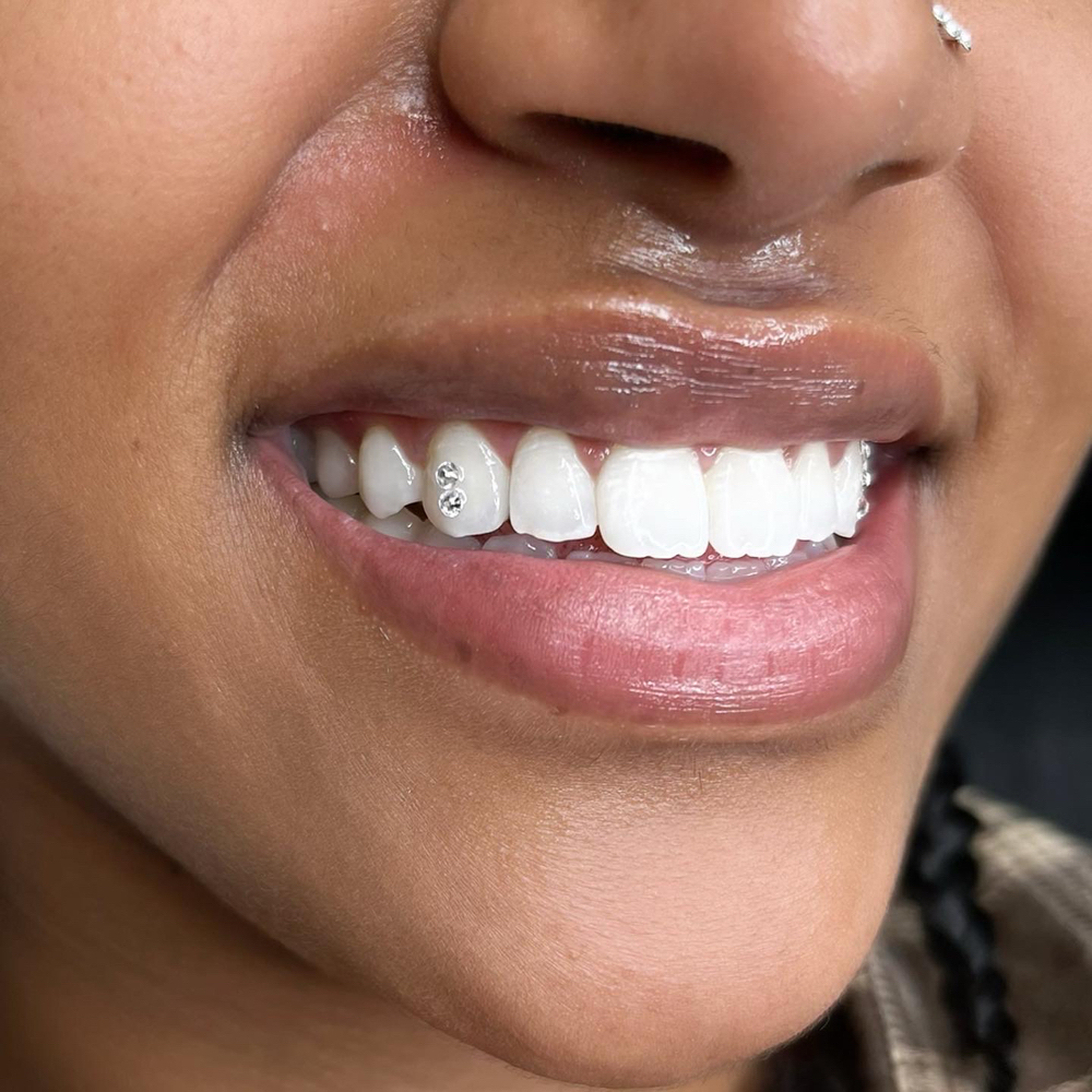Tooth Gems (2)