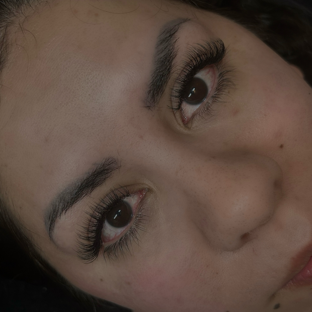 Classic Fill at Green Rose Esthetics in South Jordan, UT