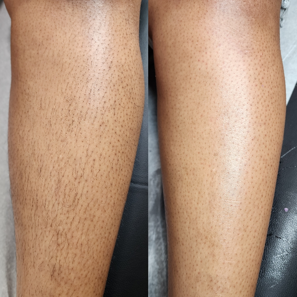 Lower Leg Wax