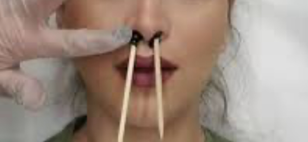 Nose