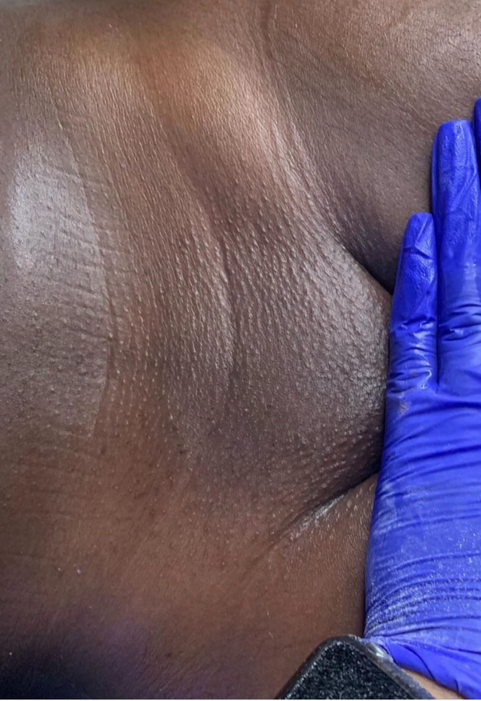 Brazilian Wax