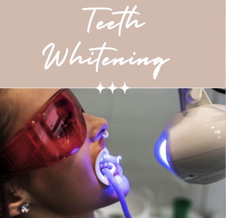 Teeth Whitening