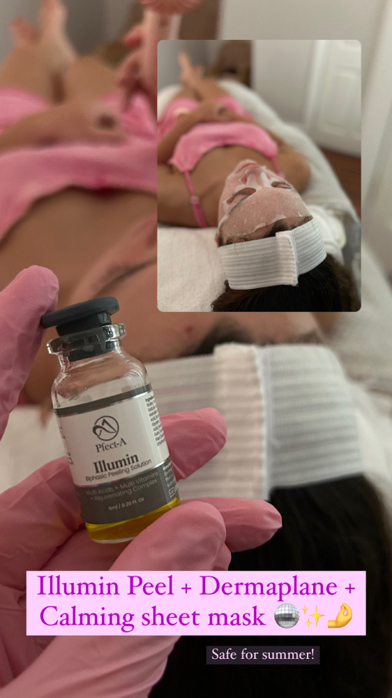 Illumin Peel at Aesthetics By Alandra in Guntersville, AL