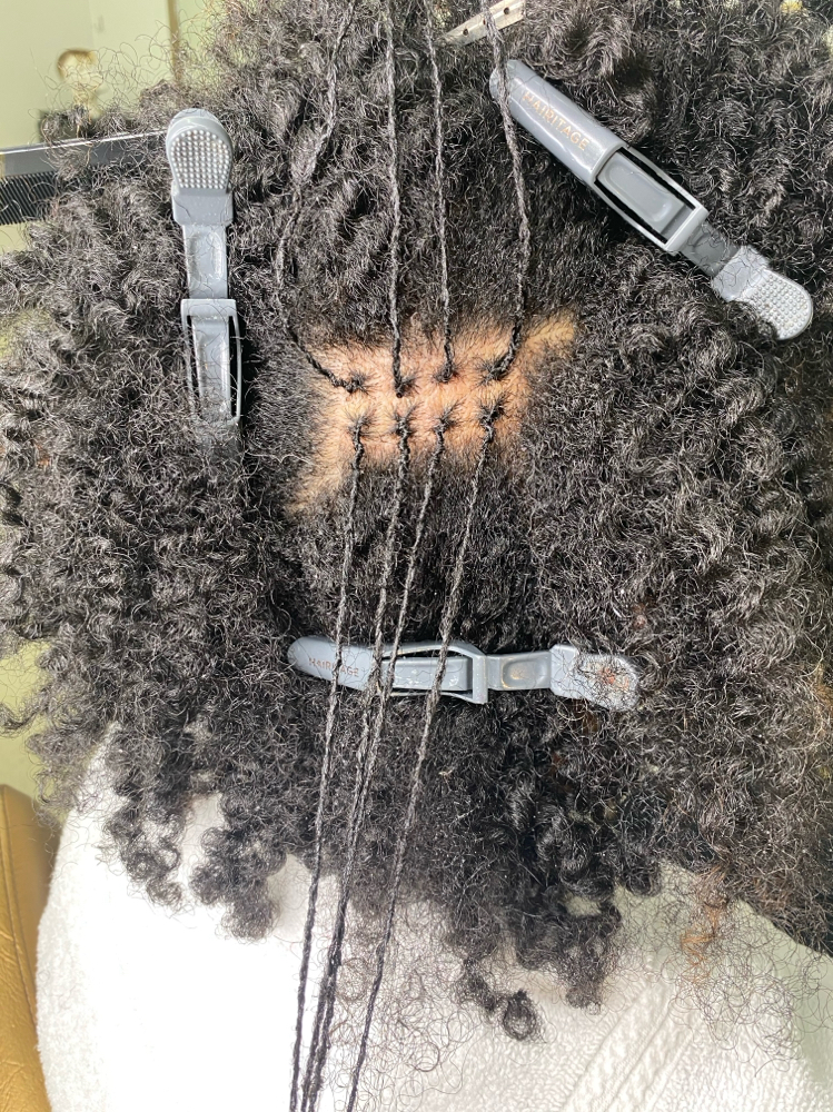 Micro Locs Consultation (Required)