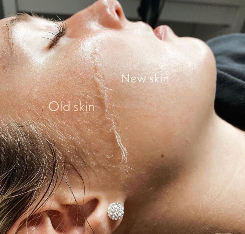 Dermaplane facial & Mask