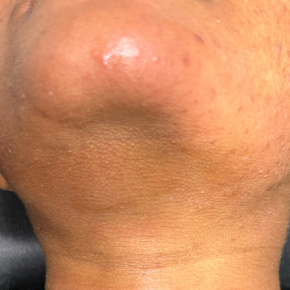 Chin at LuxurybyLarella in Houston, TX