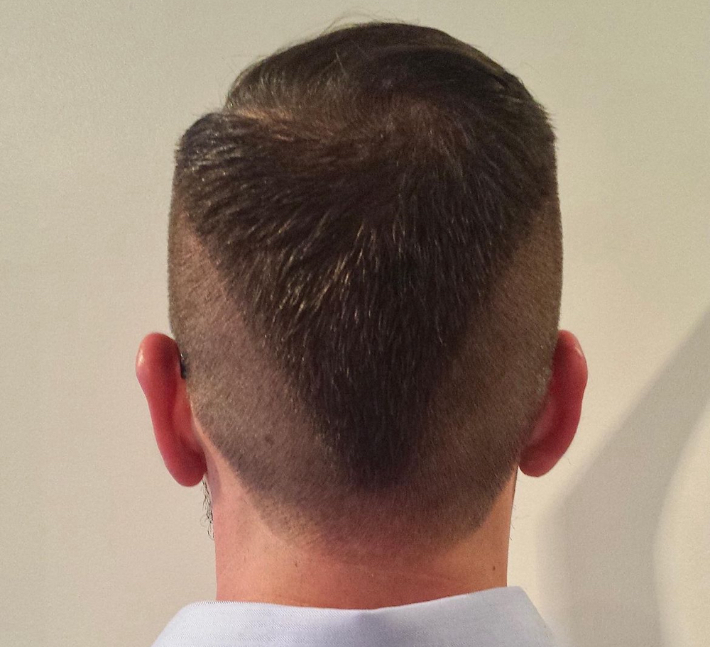 Neck Trim