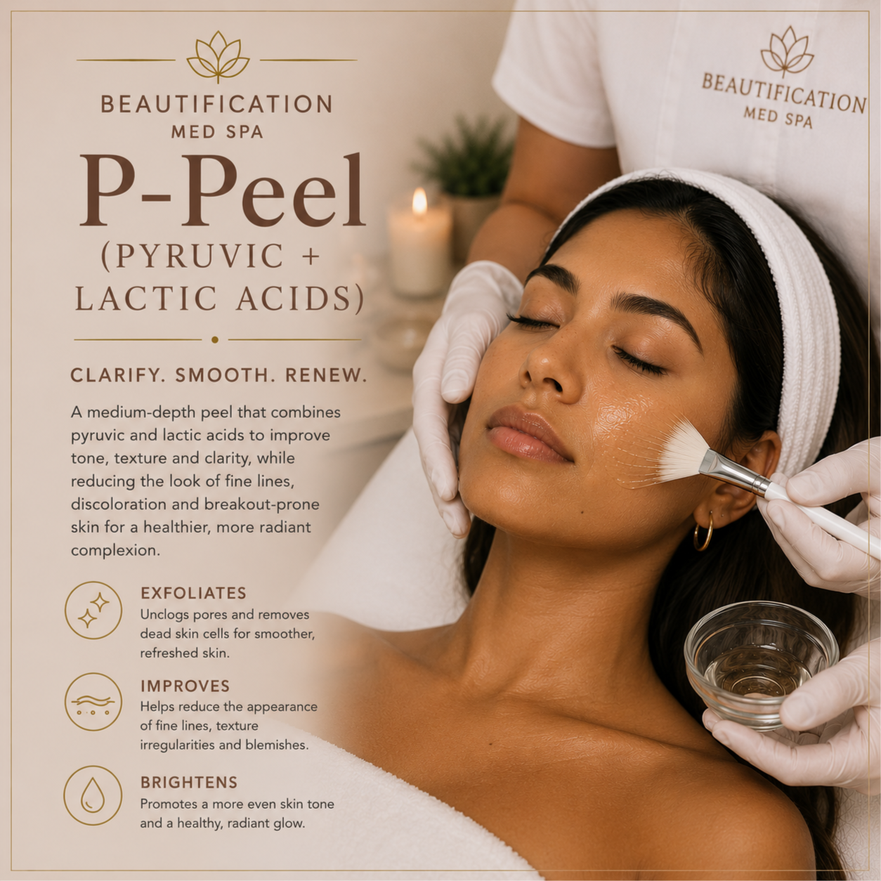 P-Peel (PYRUVIC AND LACTIC ACIDS) at Beautification MedSpa in Concord, CA