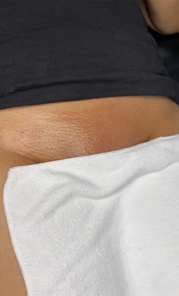 Brazilian Wax