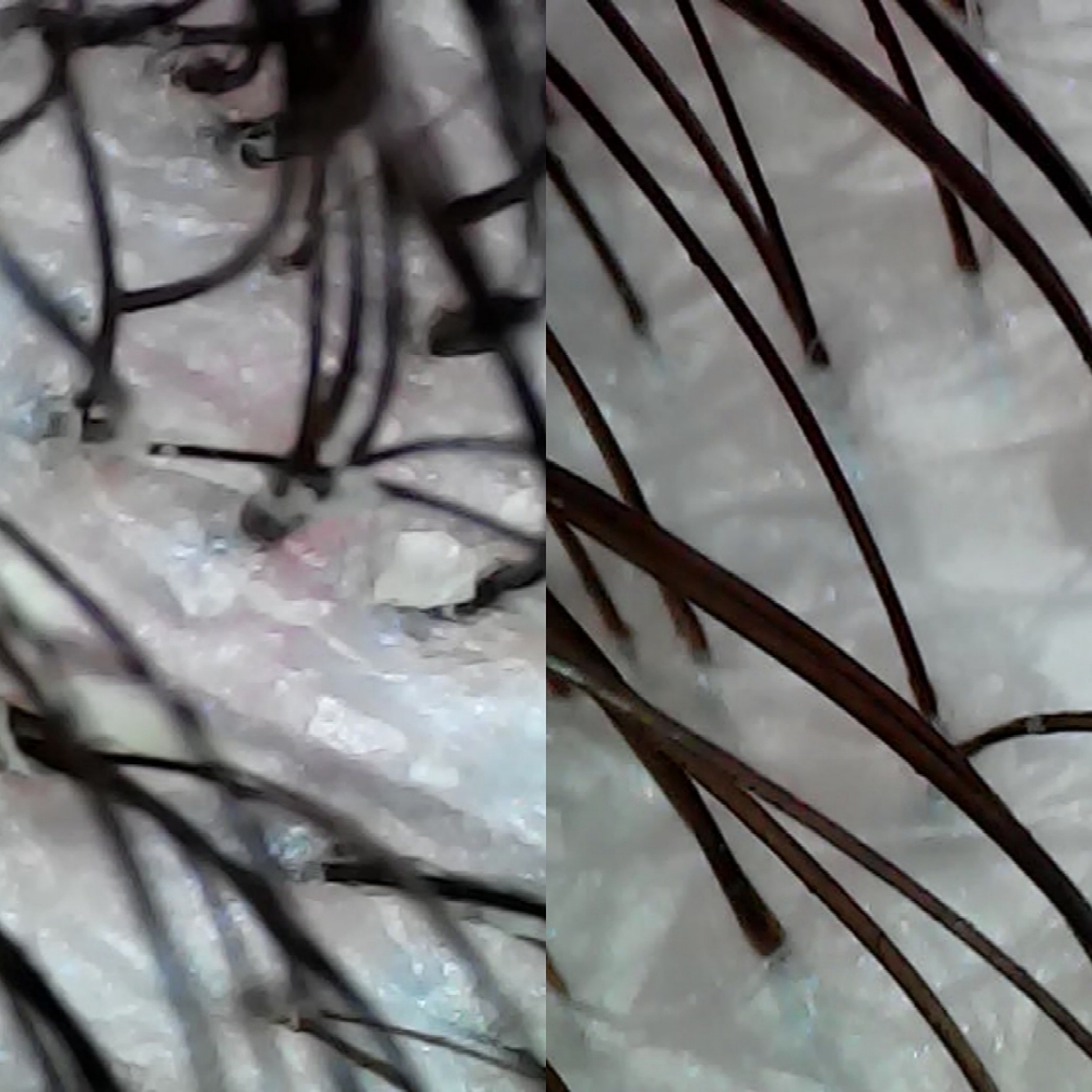 Scalp Clarifying Treatment w/ Scope at Stormie Rains Hair in Lubbock, TX