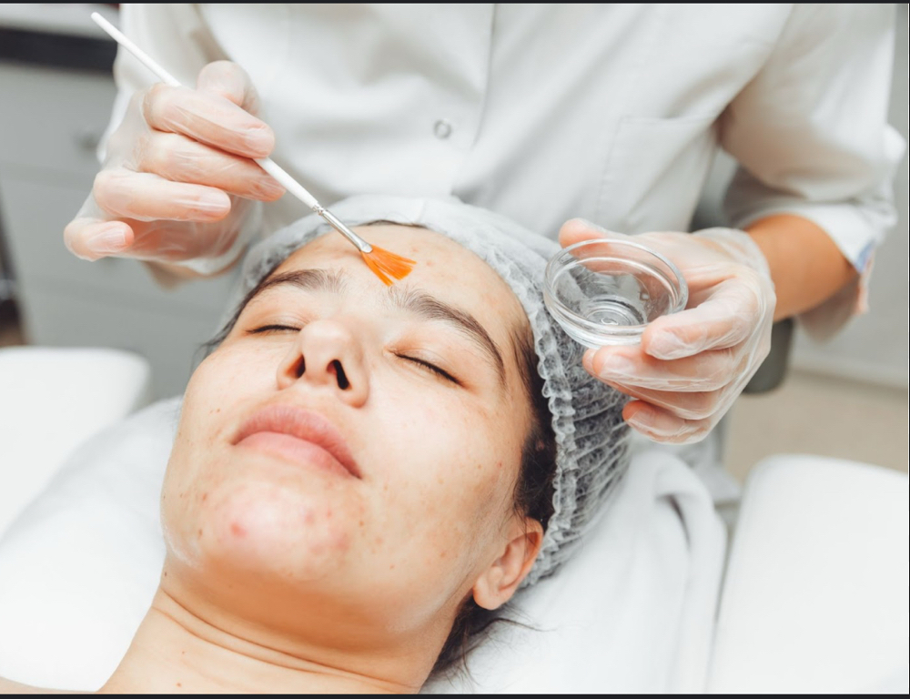 Custom Peels at Indulgence Beauty LLC in Tacoma, WA