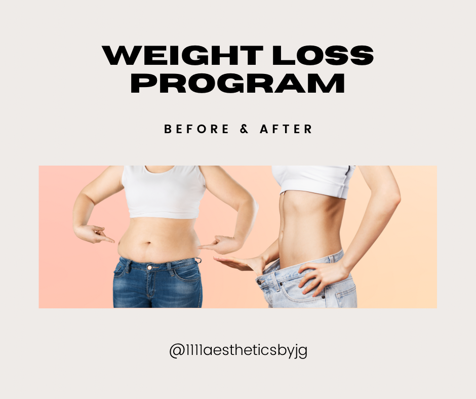 Weight Loss Program