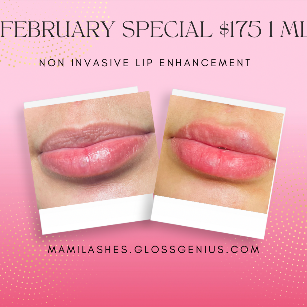 Non Envasive Lip Enhancement