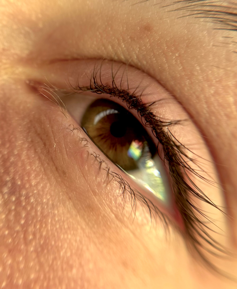 Eyelash Enhancement