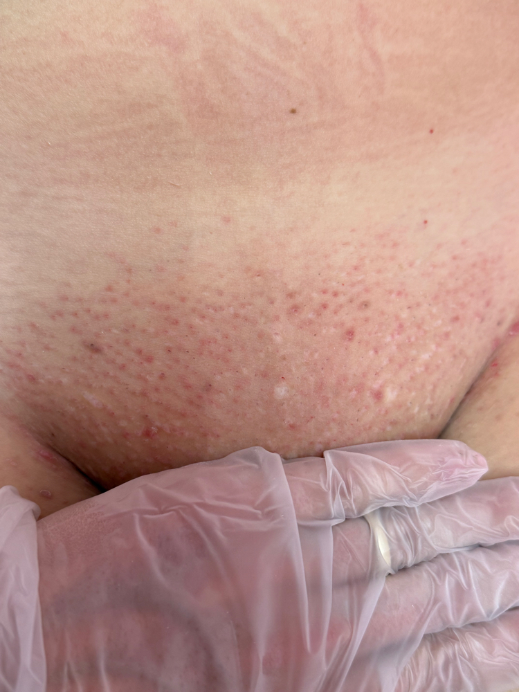 New Client Brazilian