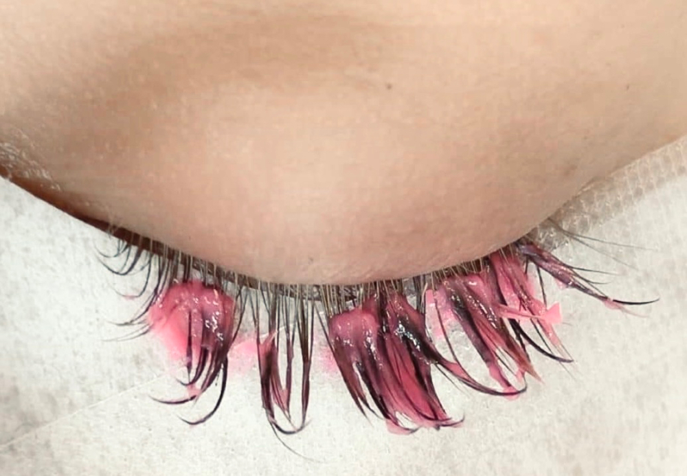 Lash Removal