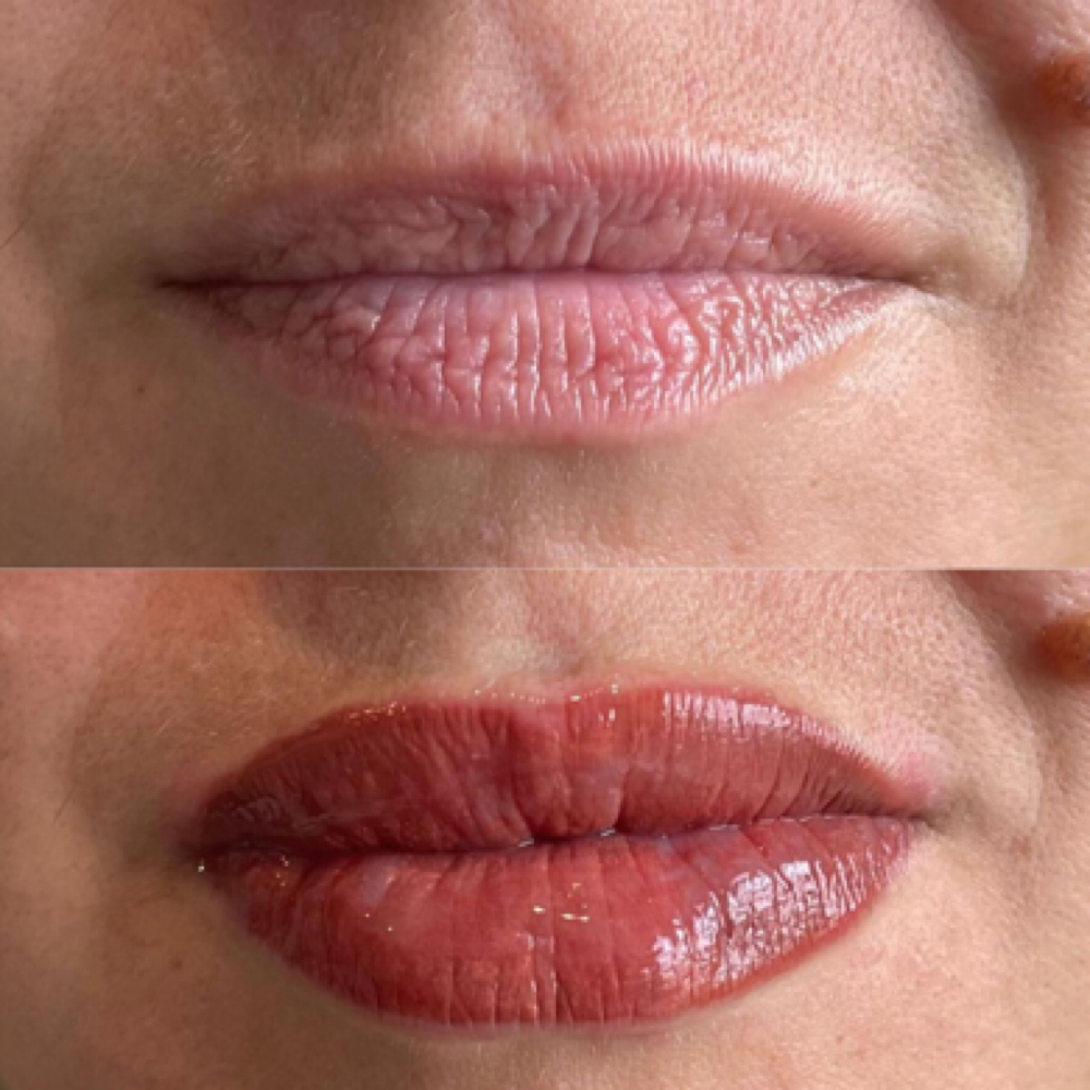 Lip Blushing Color Refresh at Innovative Medical Aesthetics in Slidell, LA