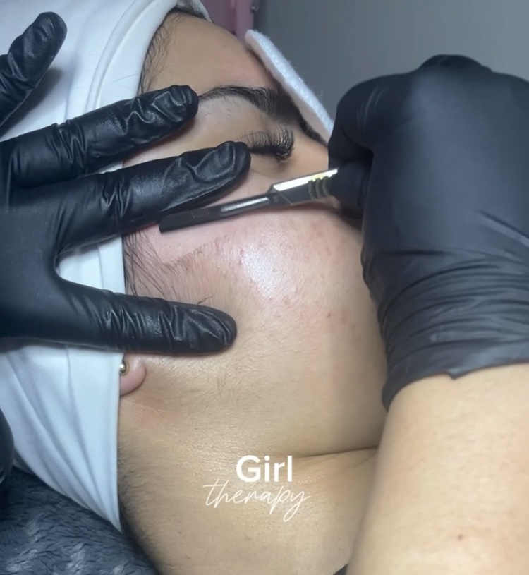 Dermaplane Add On