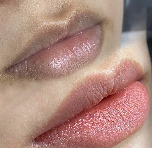 Lip Neutralization
