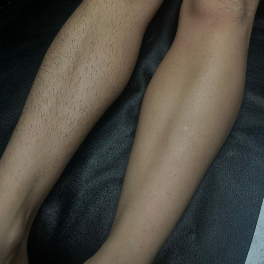 Full Leg Wax at 5StarEsthetics in Minneapolis, MN