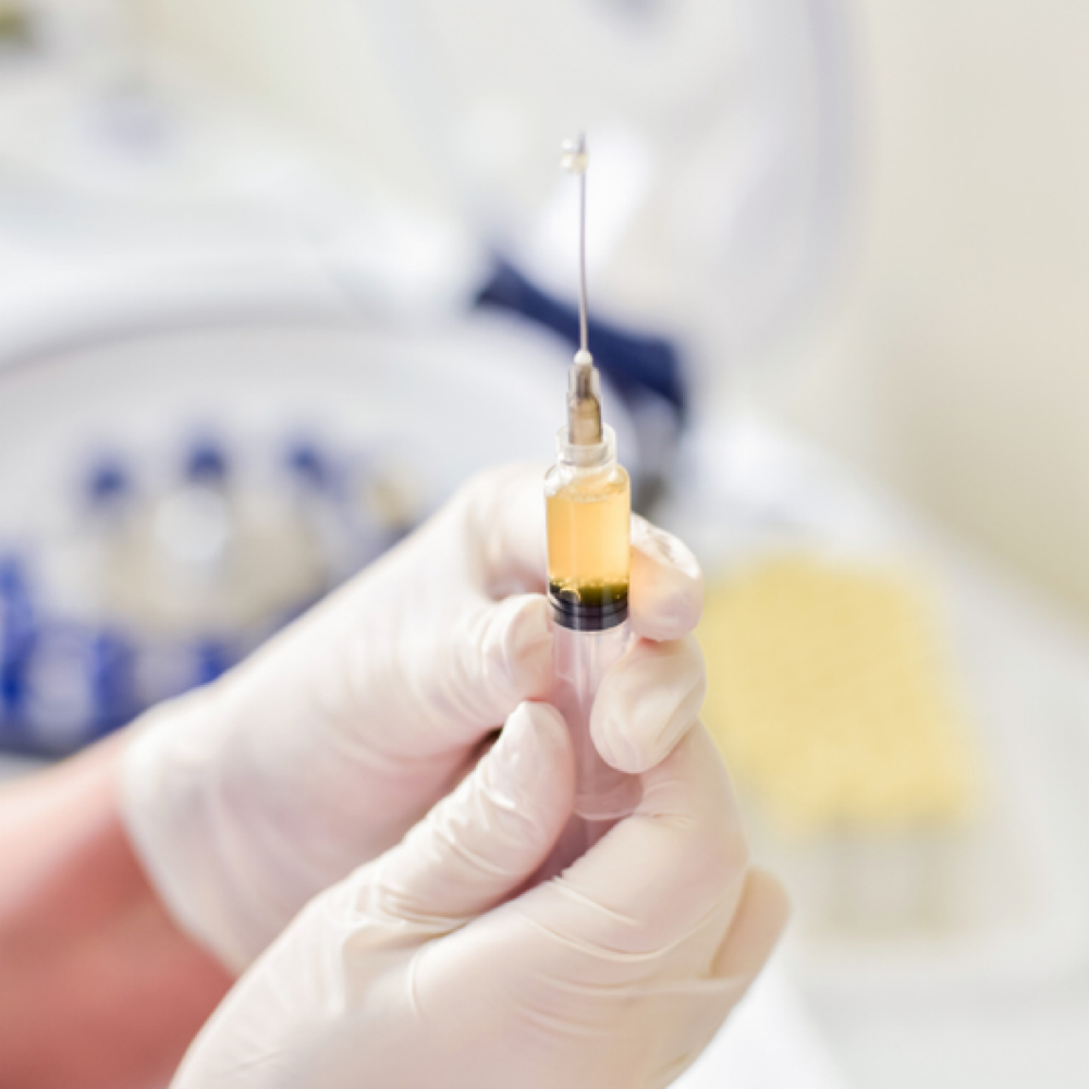 Platelet Rich Plasma