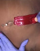 Waxing - Stomach Strip