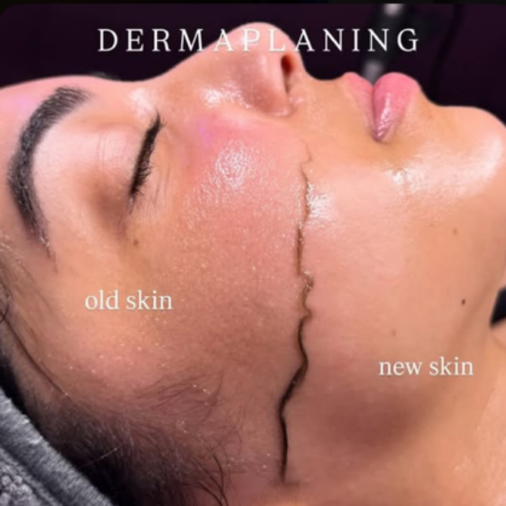Dermanplaning Facial at KayKayEstheticsLLC in Tavares, FL
