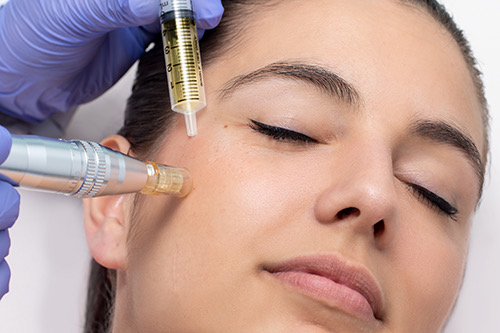 Dermapen/ microneedling treatment