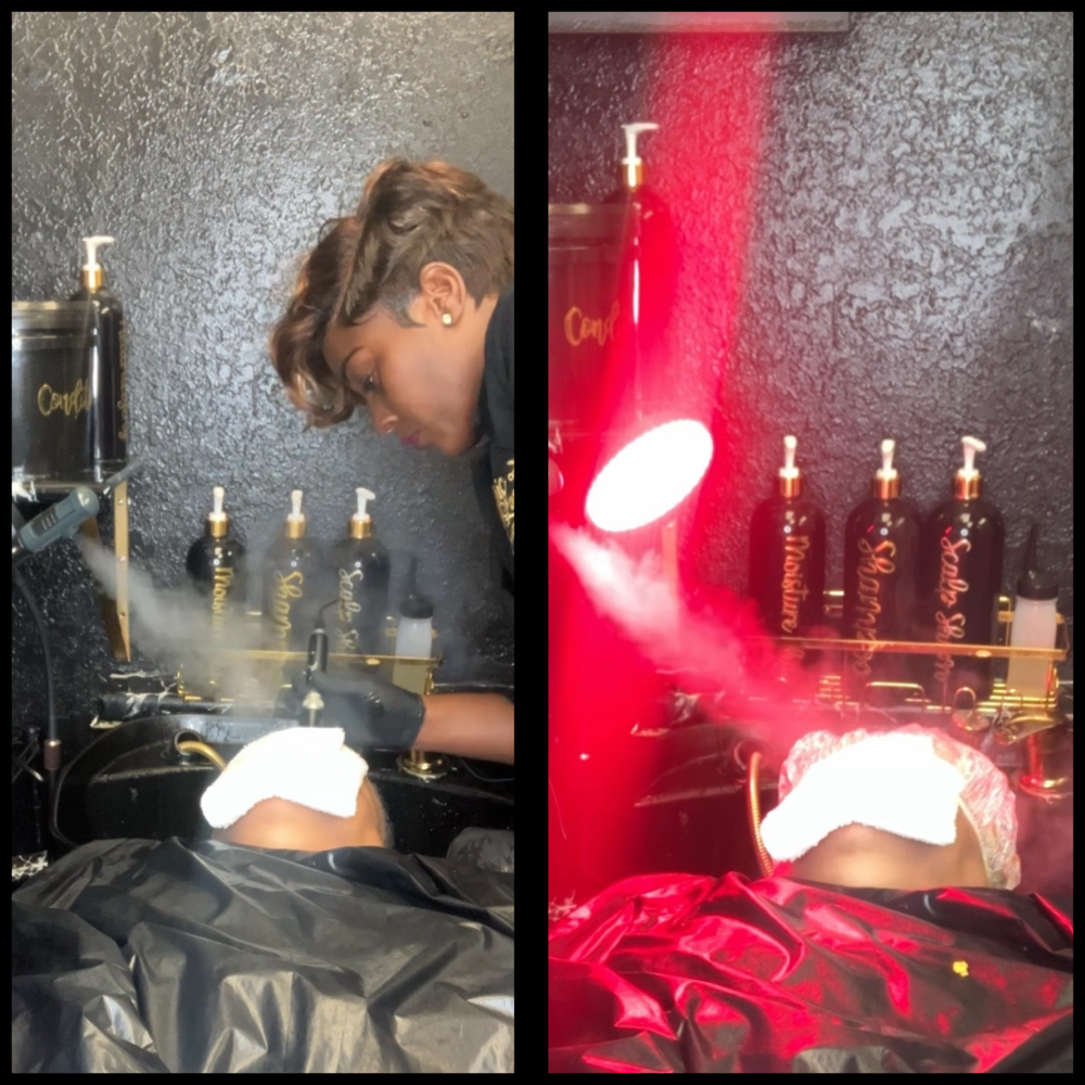 Hair Loss Or Dandruff Treatment at Epic Looks Hair And Wigs Collection in Coral Springs, FL