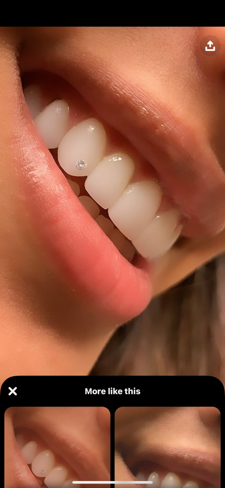 ✨Tooth Gems✨