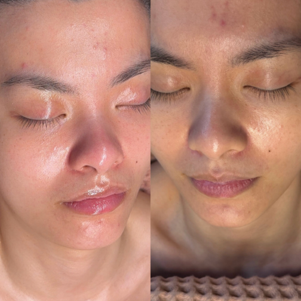 April Promo Facial (New Clients Onl at BEUNIQUEBEAUTY in Long Island City, NY