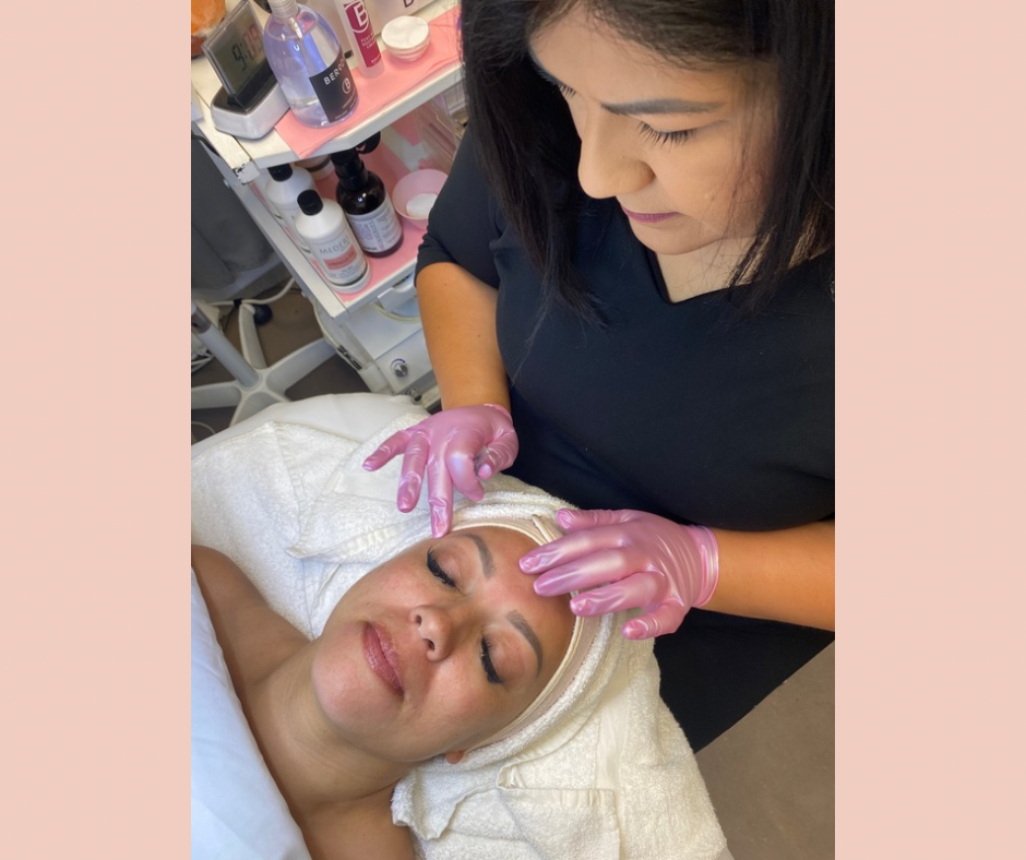 Microdermabrasion Add-On