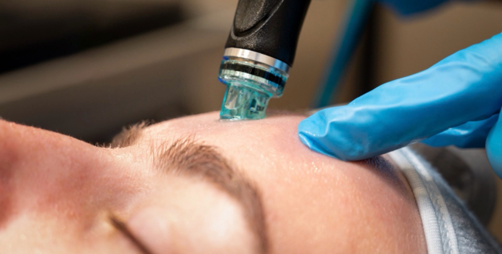 Deluxe Hydrafacial at Lace Esthetics in Chino Valley, AZ