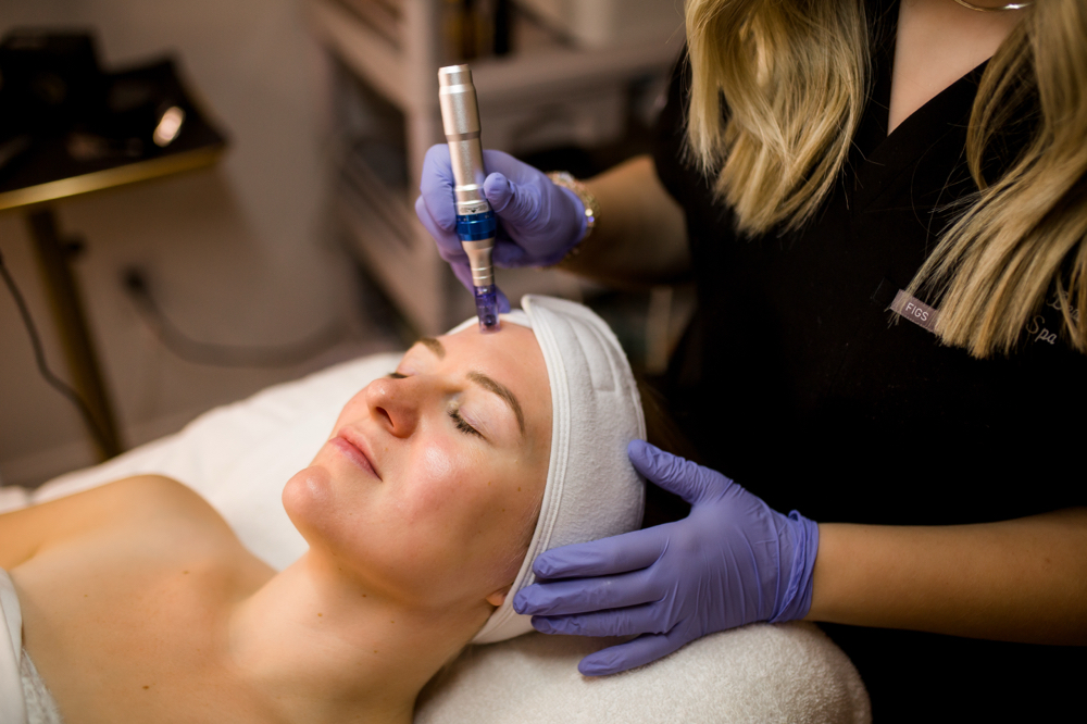 Microneedling ADD ONS