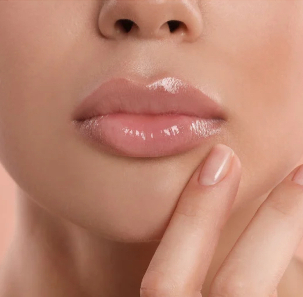 Lip Filler