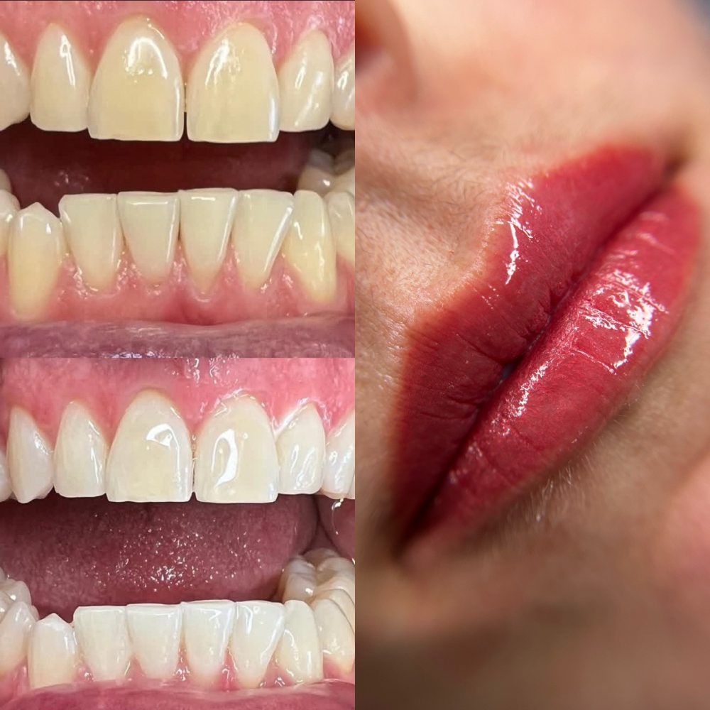 Perfect Smile Special 💋🦷✨
