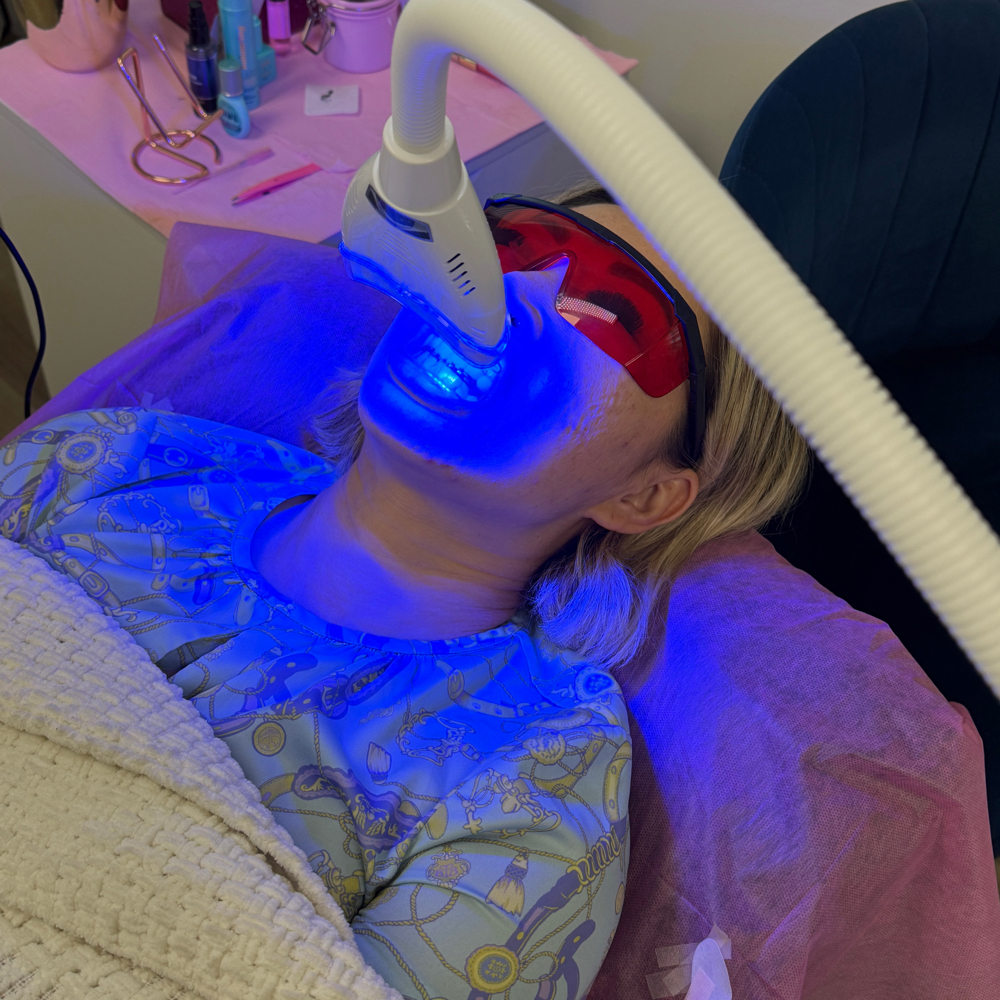 Teeth Whitening at PURPLE LASHES & BROWS in Key West FL, FL