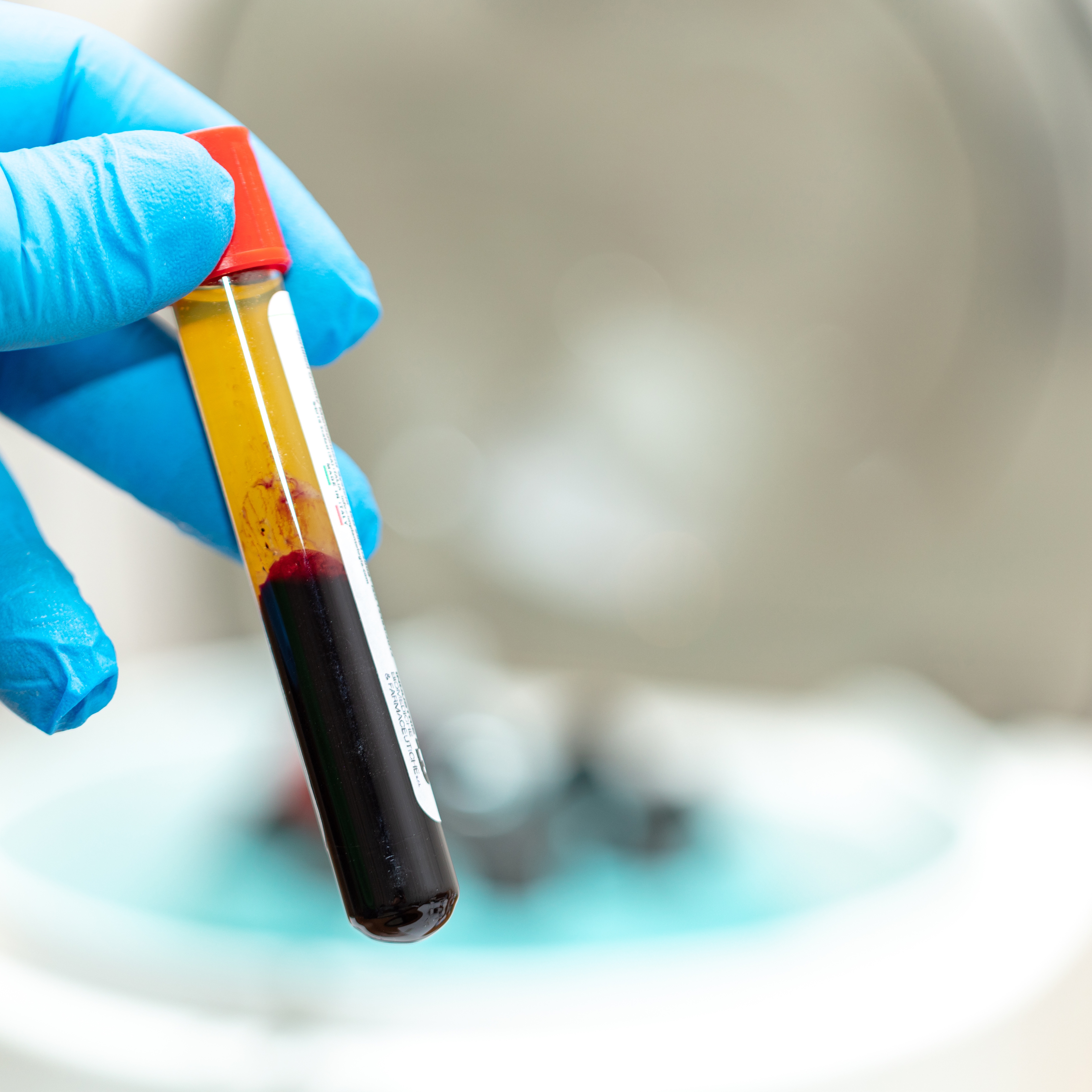 Facial Microneedling at T&N Skin Med Spa Inc in Abington, PA