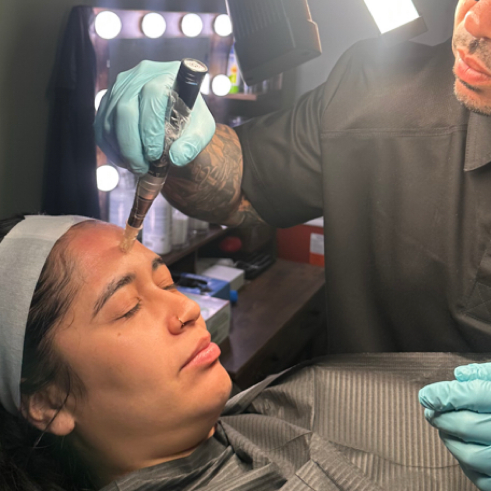 Microneedling With Facial Serum at T&N Skin Med Spa Inc in Abington, PA
