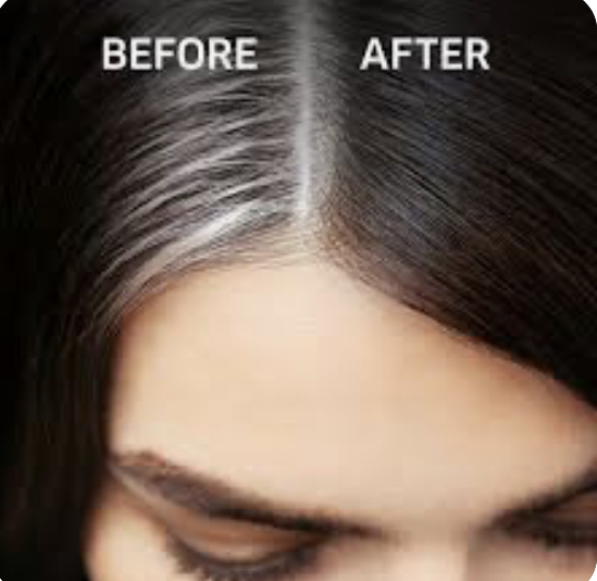 Root Touch Up